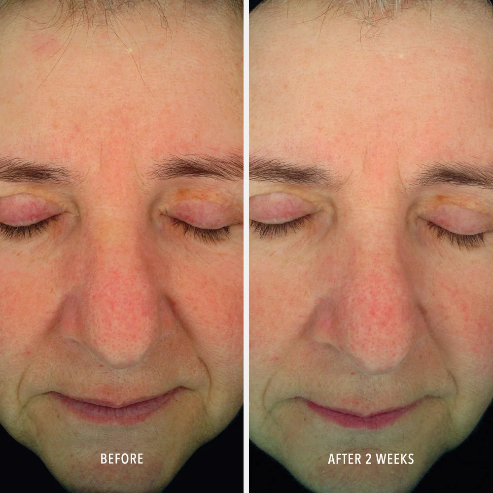 Image of HydroPeptide Soothing Serum 30ml