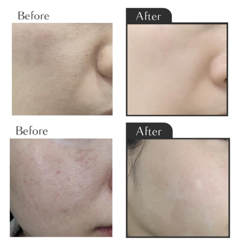 Image of House of B 99% Glutathione Face Film