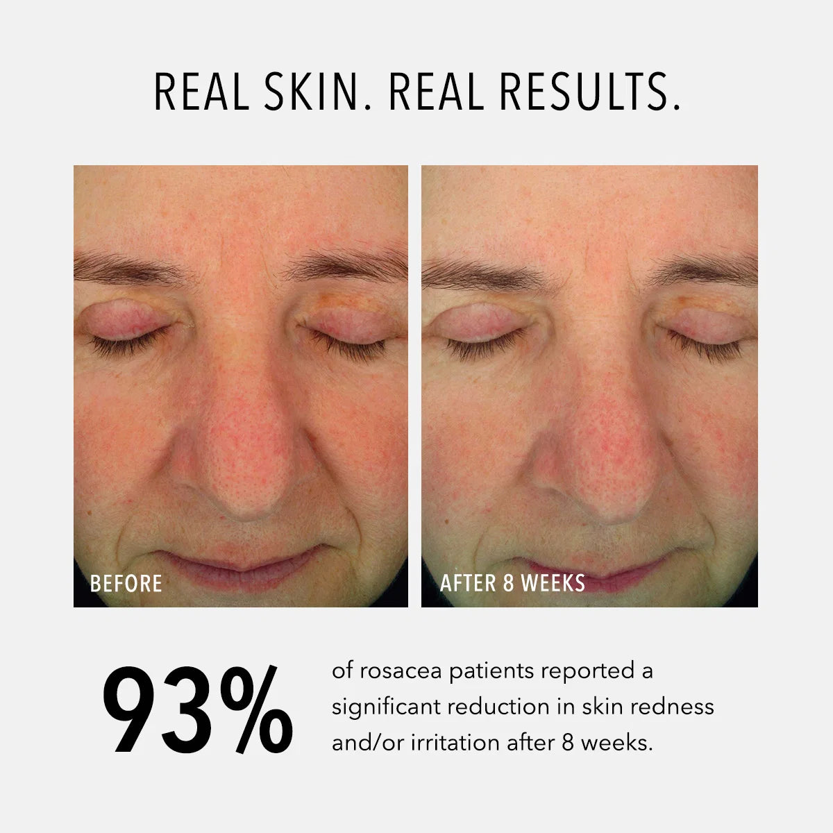 Image of HydroPeptide Soothing Serum 30ml