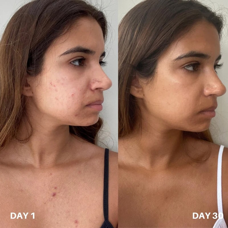 Image of Clinisoothe+ Skin Purifier Spray 100ml