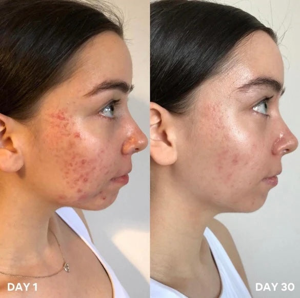 Image of Clinisoothe+ Skin Purifier Spray 100ml