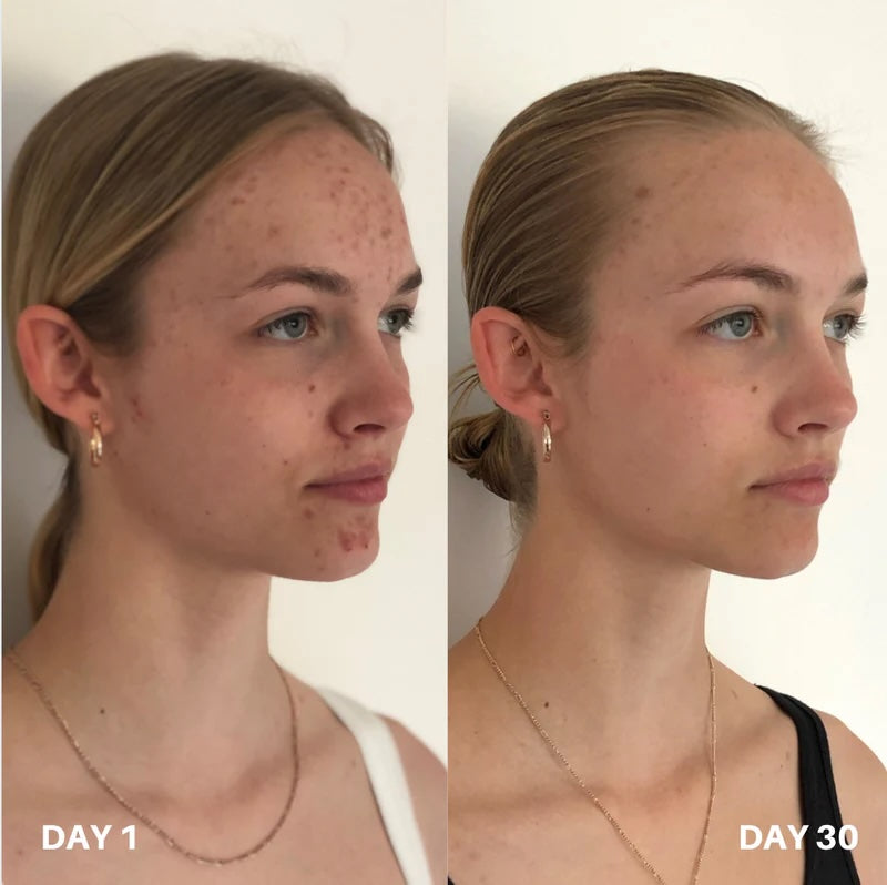 Clinisoothe+ Skin Purifier Spray 100ml