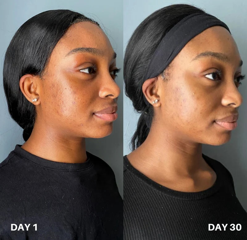 Image of Clinisoothe+ Skin Purifier Spray 100ml