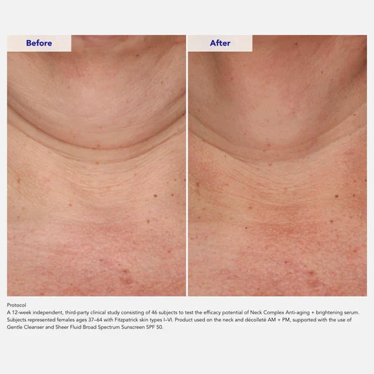Image of ZO Neck Complex Anti-Aging + Brightening Serum 50ml